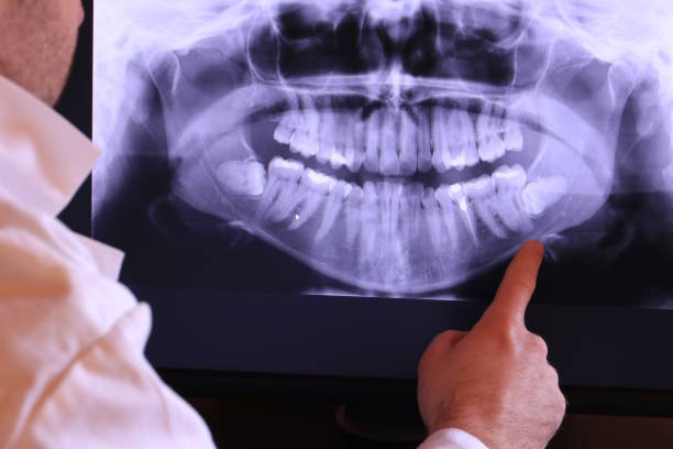 Best Emergency Broken Tooth Repair in Manchester, MD