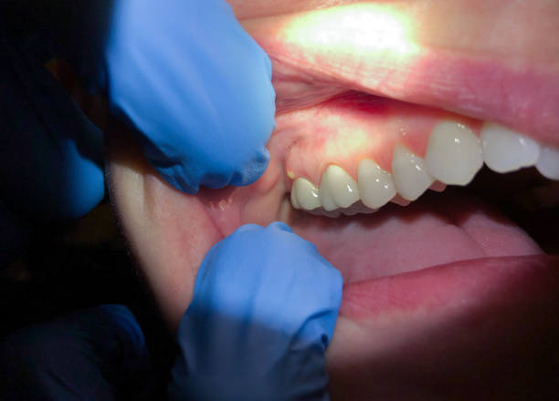 Best Walk-In Emergency Dentist in Manchester, MD